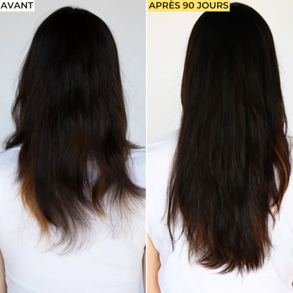 Cure Cheveux Anti-Chute