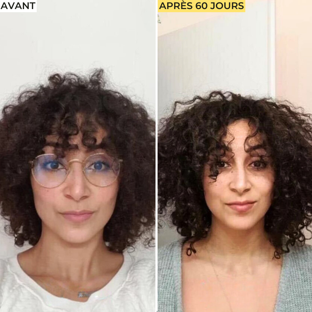 Cure Cheveux Anti-Chute