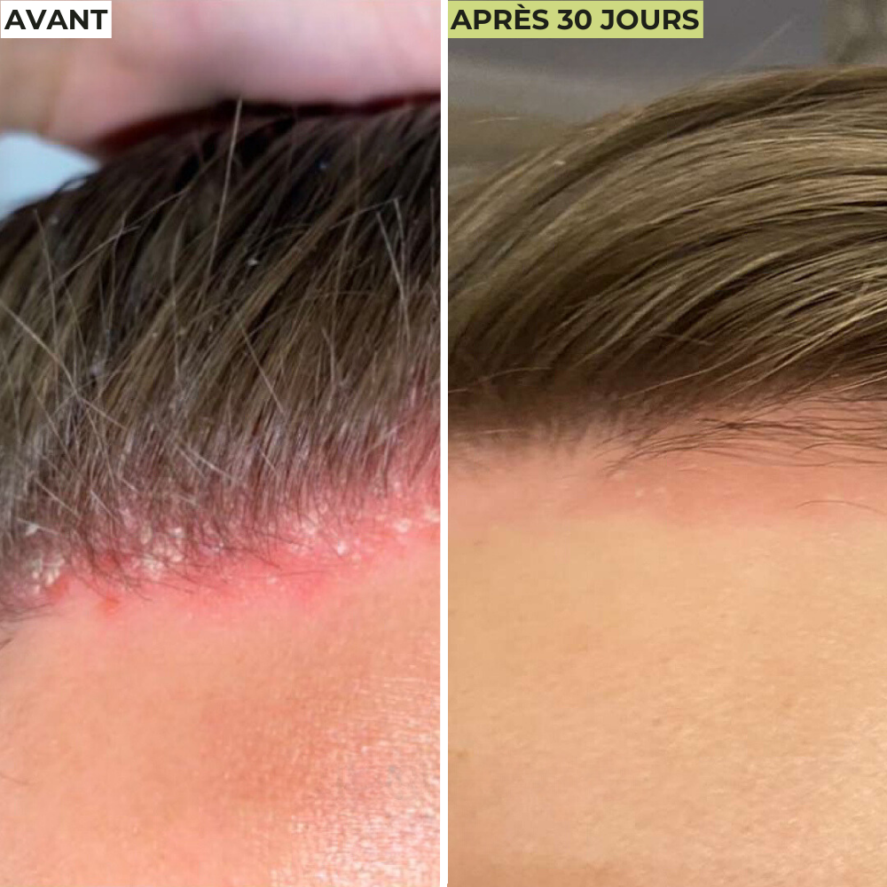 Cure Cheveux Détox
