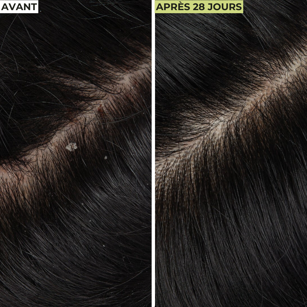 Cure Cheveux Détox