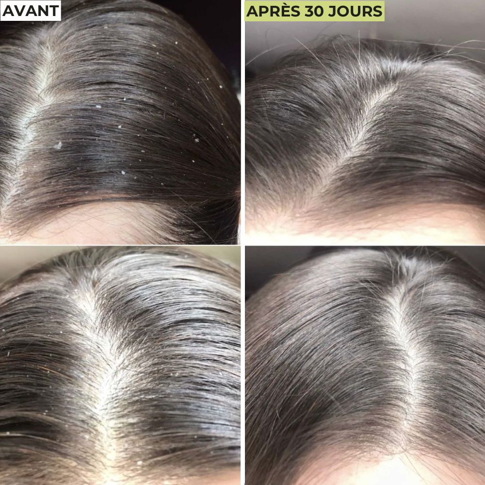 Cure Cheveux Détox
