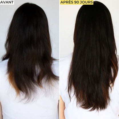 Cure Cheveux Anti-Chute