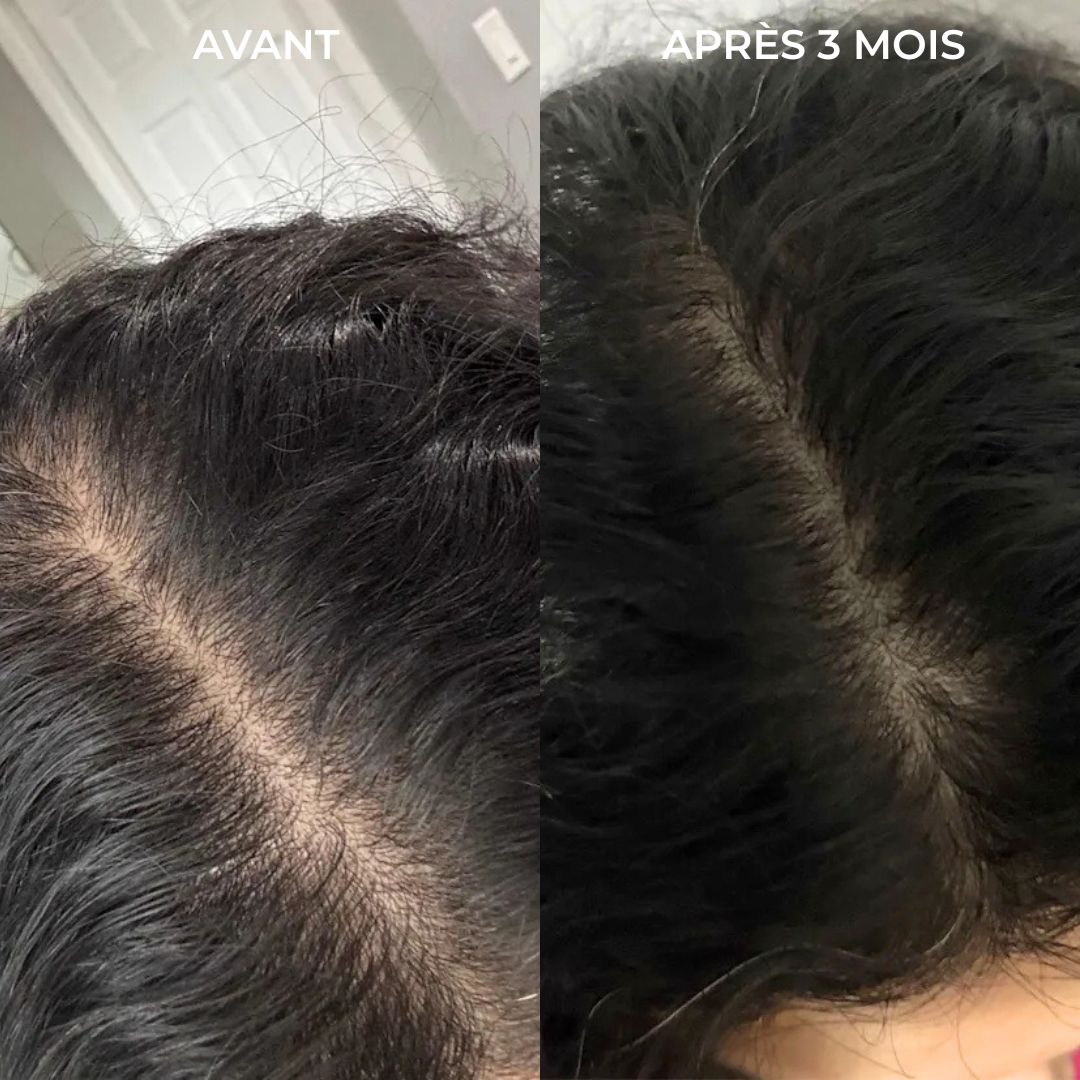 Nōmow - Huile Capillaire Fortifiante